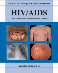 Atlas HIV AIDS